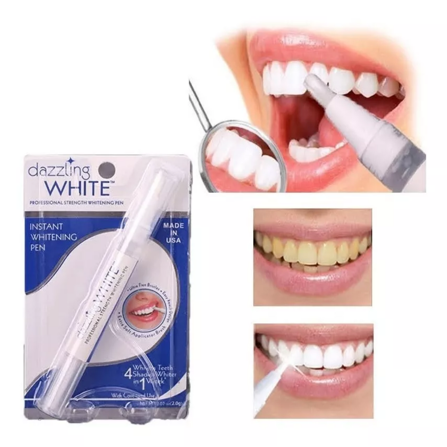 MySmile™ - Bolígrafo blanqueador de dientes